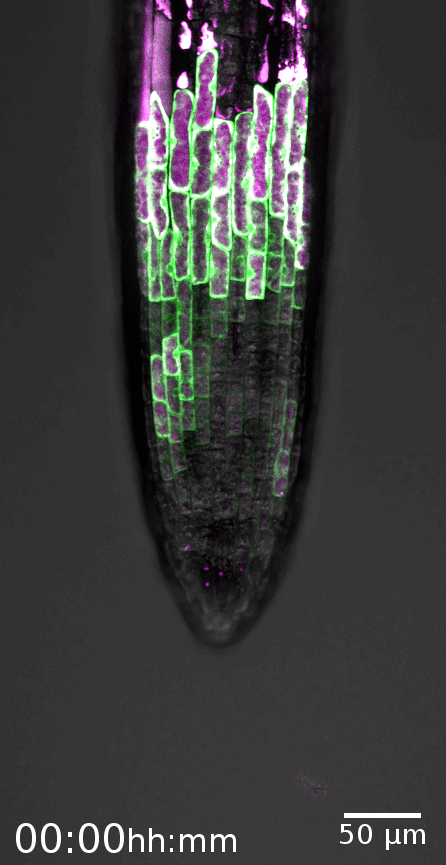 root cap cell death