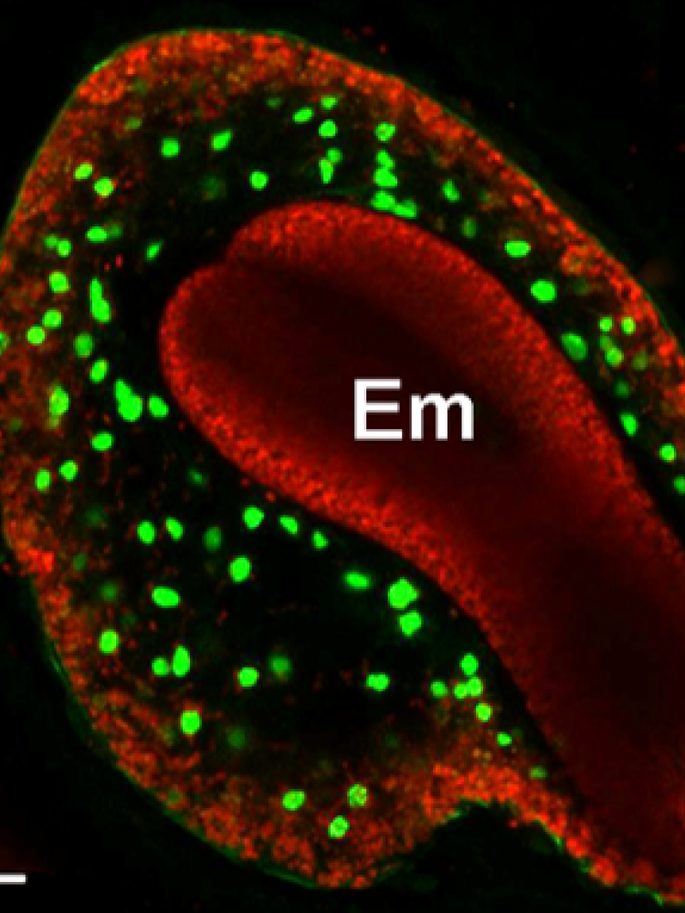 endosperm cell death